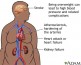 obesity-and-health